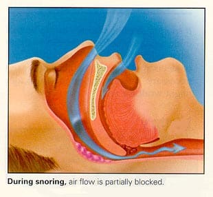 duringsnoring