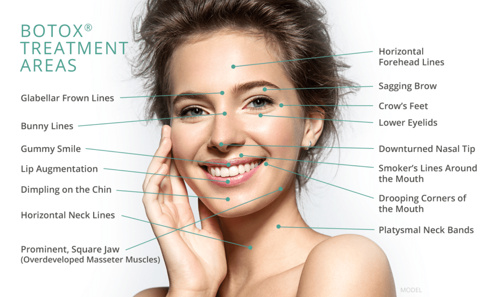 botox features