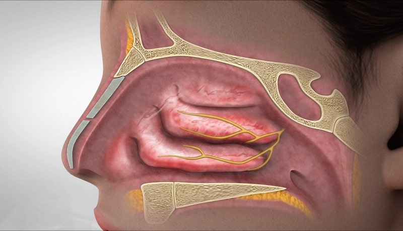 Nasal Nerves